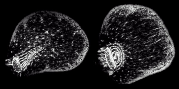 Garlic MRI image