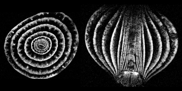 Onion MRI image