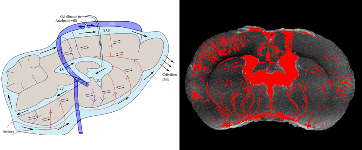 Actual MRI cross-section of the mouse brain, showing injection site