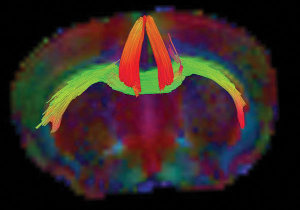 An MRI tractography image of a mouse brain