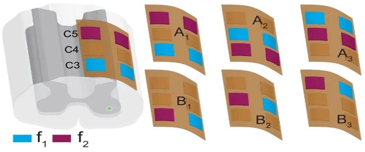Epidural electrode grid C3–C5 with three bipolar (A1, A2, and A3) and three monopolar conﬁgurations (B1, B2, and B3); actual wire width is 25 µm.