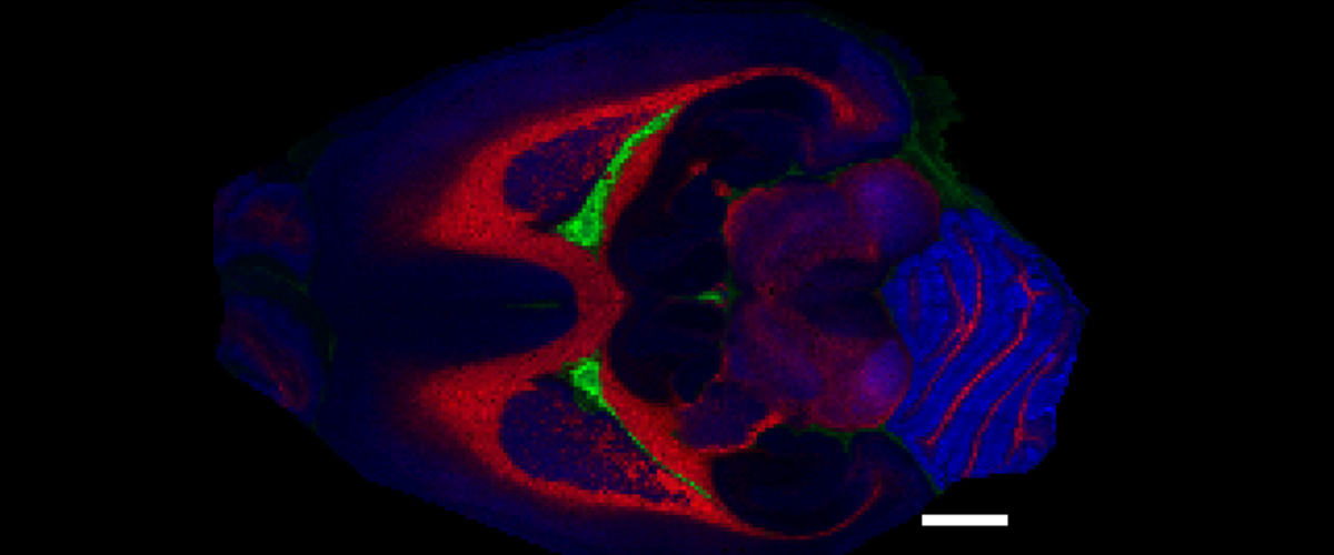 This image of a rat brain, generated with the MagLab's 21-tesla ICR mass spectrometer, reveals the distribution of three specific lipids.