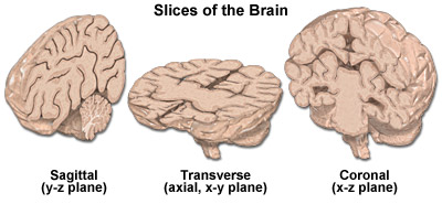 Slices of the brain