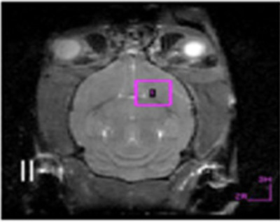 MRI image of rat brain
