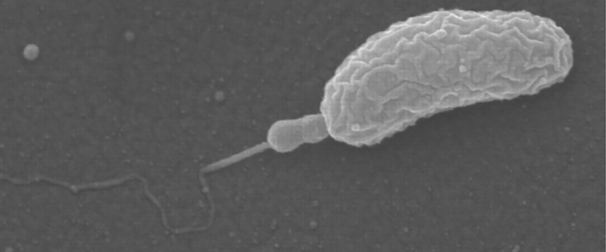 The predatory bacteria called BALOs attacking another bacteria with its "kiss of death."