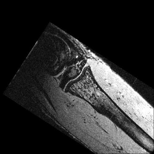 in vivo image of a mouse leg bone