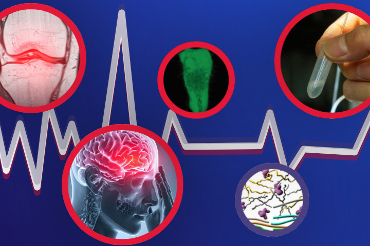 Illustration of health research