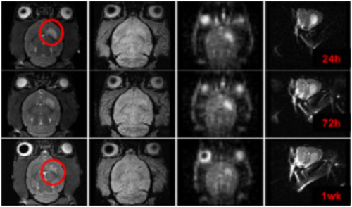 Scans of rat brains showing stem cell impact on stroke lesions.