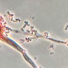 Microscopic image of the fungus Aspergillus fumigatus