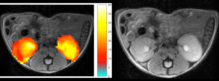 At right is an MRI image of healthy mouse kidneys (circled in red). At left, the same image is overlaid with CEST contrast obtained after the mouse was injected with creatine or phosphocreatine. The yellower areas indicate a higher concentration of the injected compound. Scientists can contrast these CEST images with others taken at different times or with diseased animals to visualize kidney function and detect kidney disease.