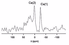 Example of an NMR spectrum.