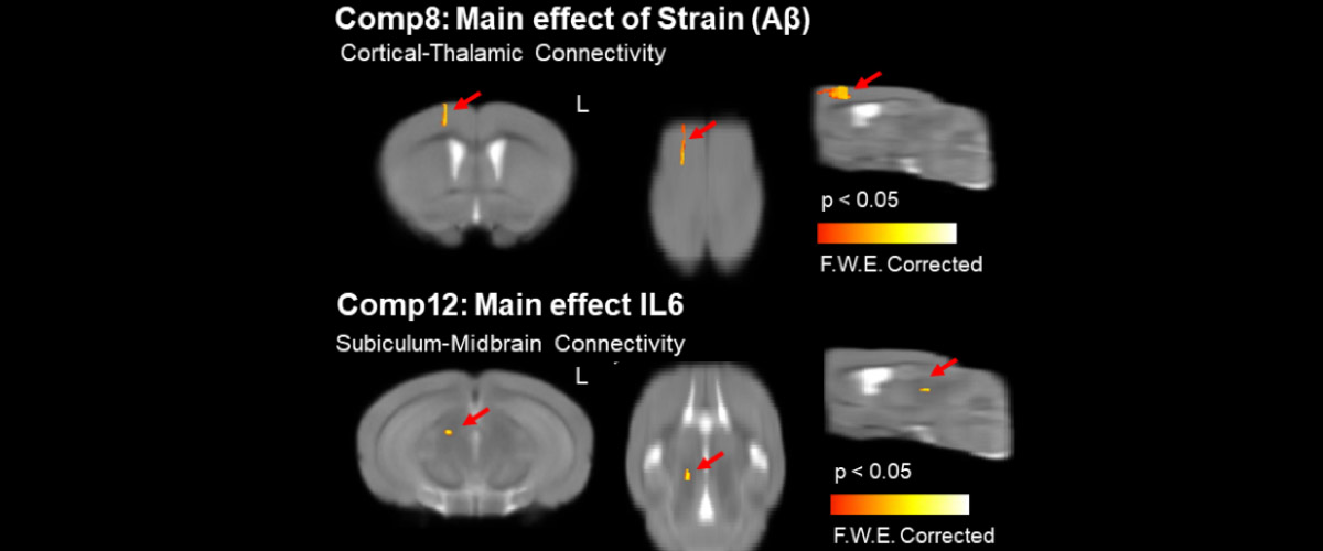 Resting state functional MRI at 11.1T revealed the effects on brain microstructures and intrinsic activity due to β-amyloid (Aβ) plaque deposits and inflammation, as indicated by the presence of the inflammatory protein interleukin-6 (IL6).