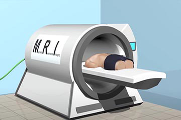 MRI thumbnail