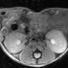 A mouse kidney