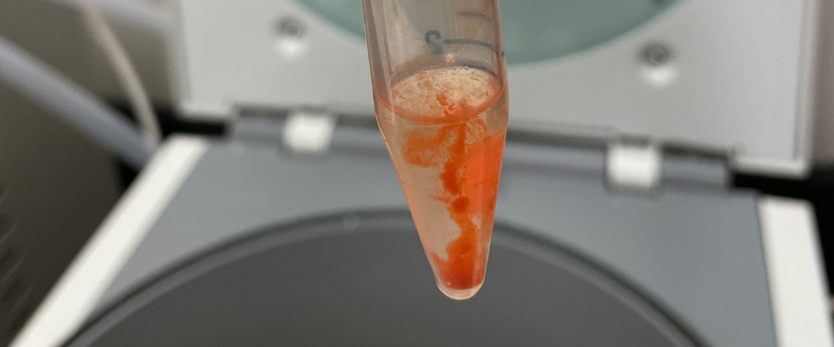 Whale Poop Sample