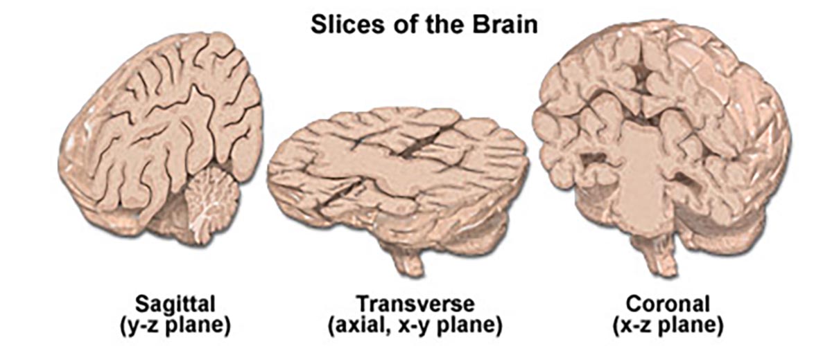 Slices of brain