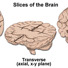 Slices of brain