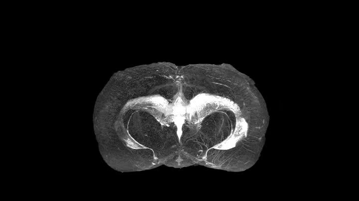 The animation of the perivascular space in a rat's brain from MRI scans