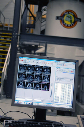 Images of a rat brain. The animal is being examined in the 900 MHz magnet in the background.