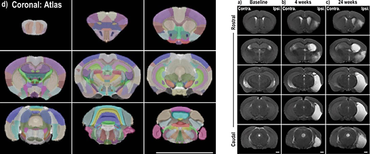 Anatomical MRI of representative Acomys brains.