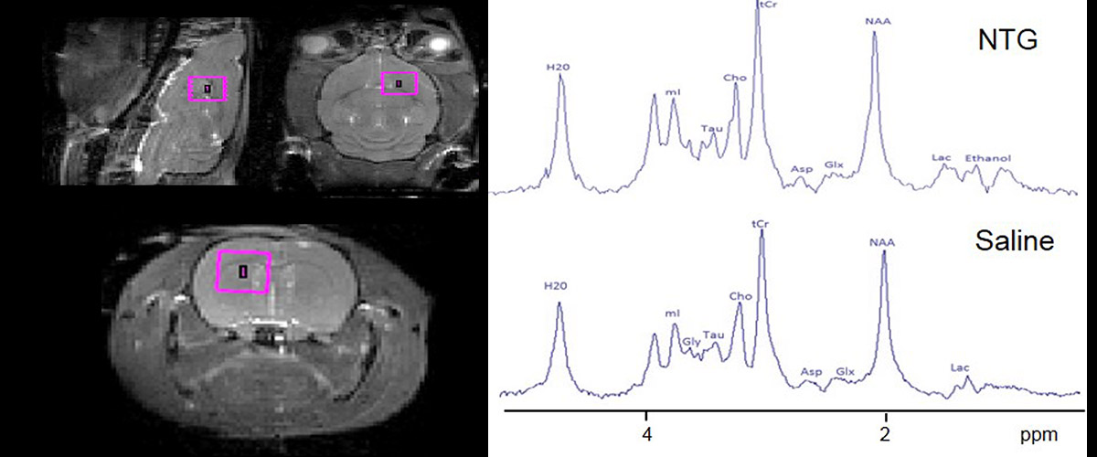 Using MagLab-developed NMR pulse sequences, volumes in the rat cortex (pink boxes) are selected to acquire relaxation-enhanced 1H NMR spectra over 3 hours.