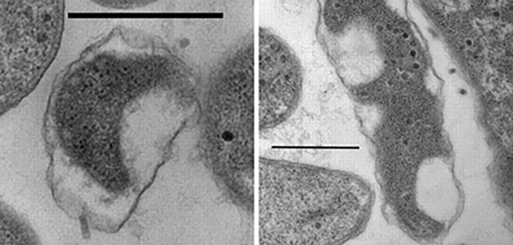 Left: A bacteria cell infected by a BALOs cell. Right: A bacteria cell infected by viruses and BALOs.